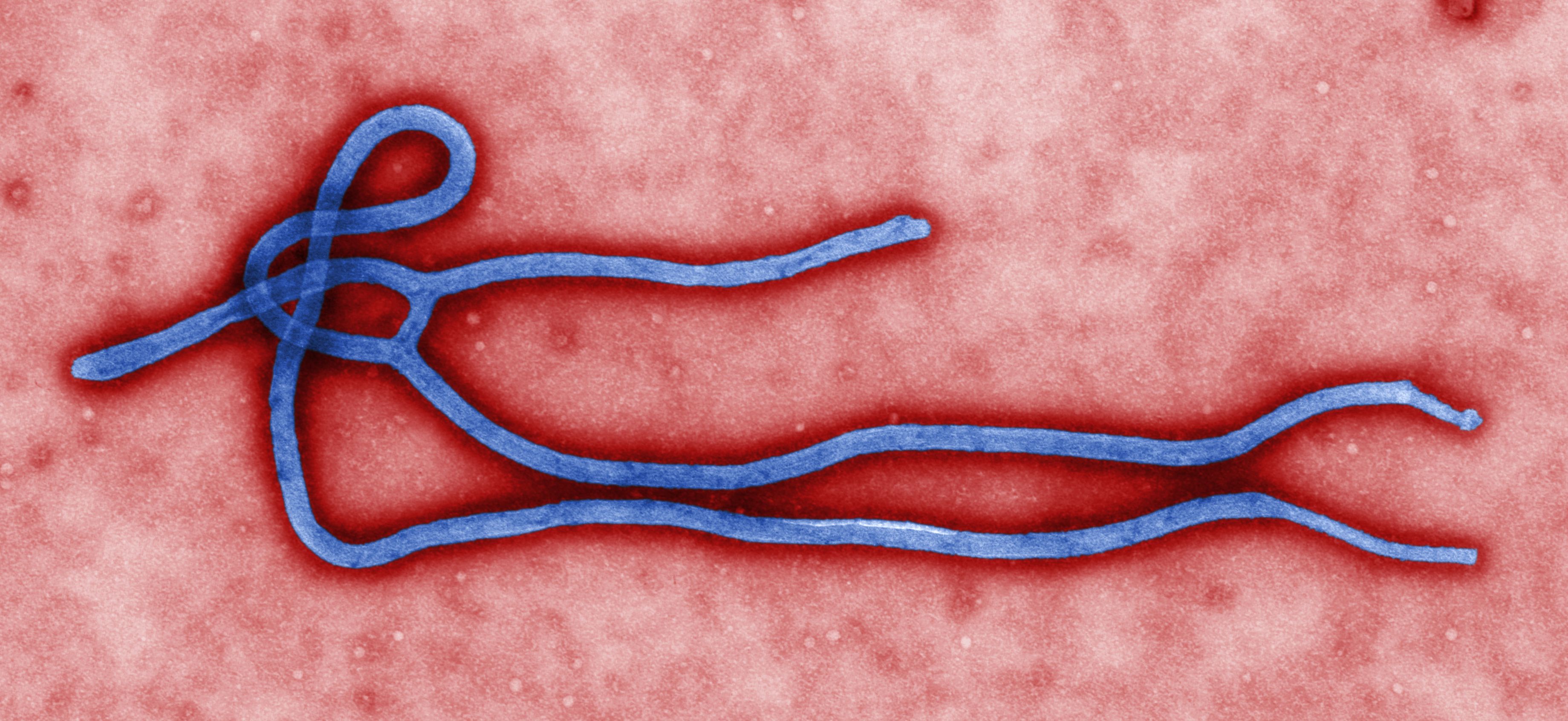 Cynthia Goldsmith....This Colorized Transmission Electron Micrograph (TEM) Revealed Some of the Ultrastructural Morphology Displayed by an Ebola Virus Virion. See PHIL 1832 for a Black and White Version of This.jpg